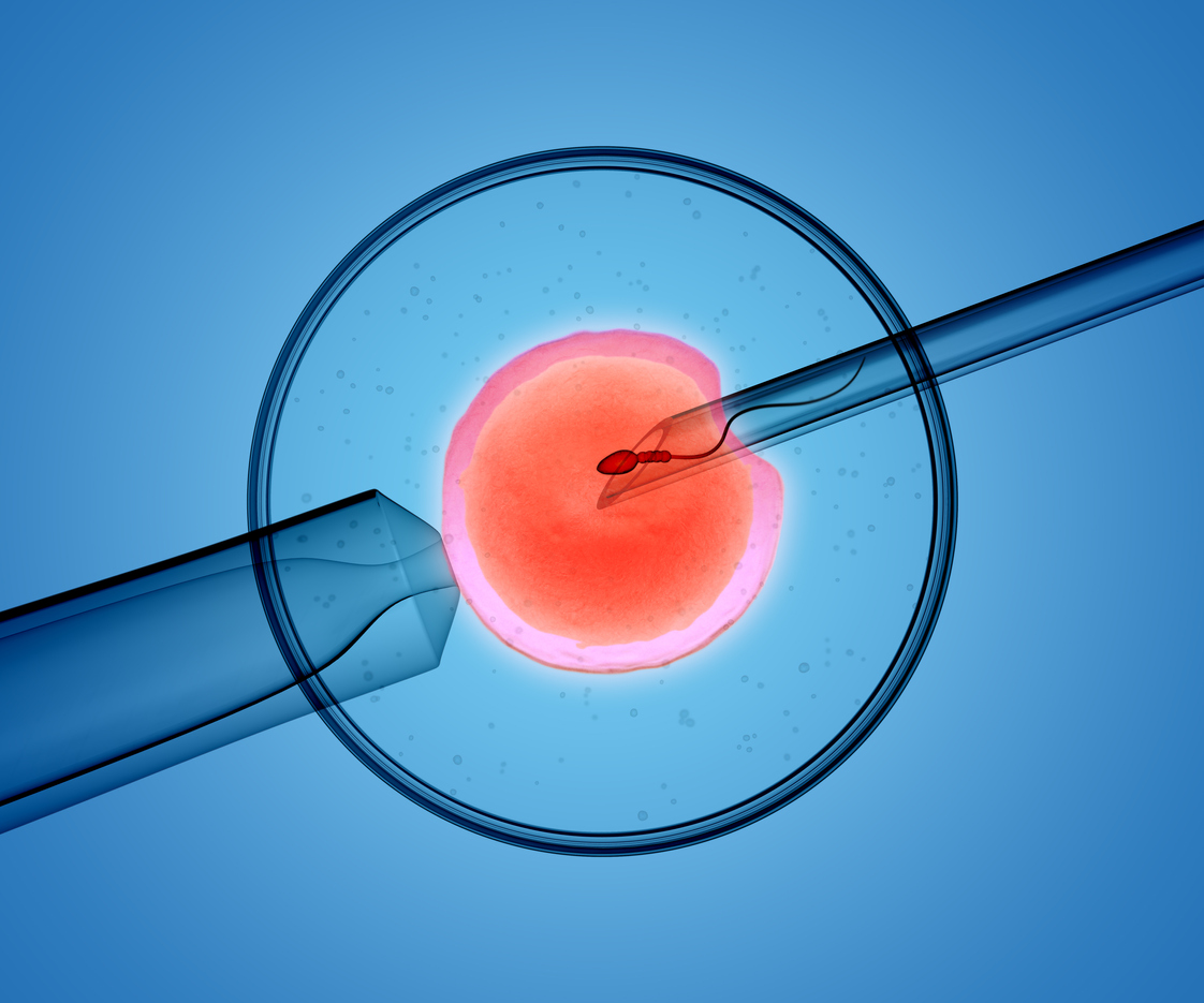 IVF medical procedure 1