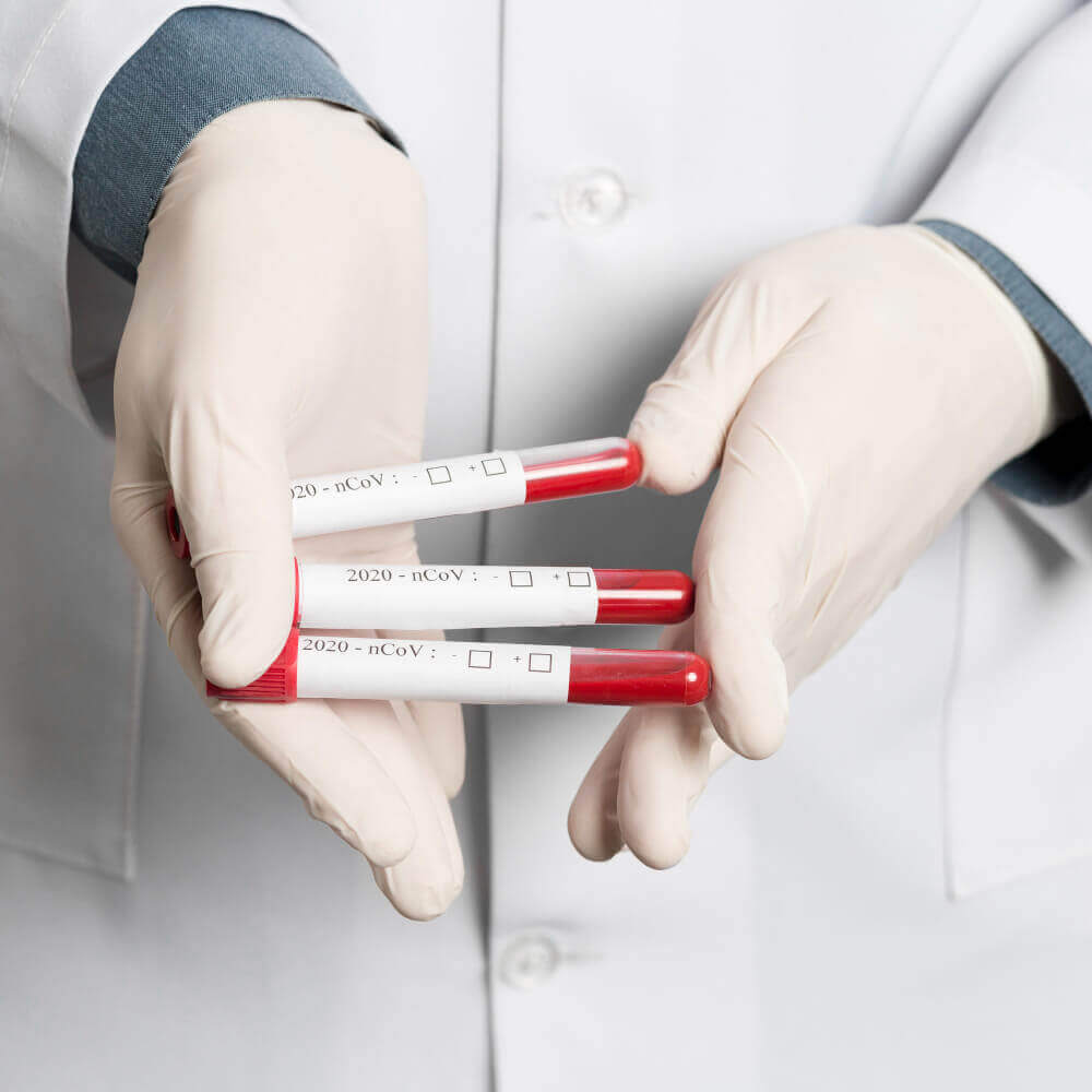 close up doctor holding vacutainers 1